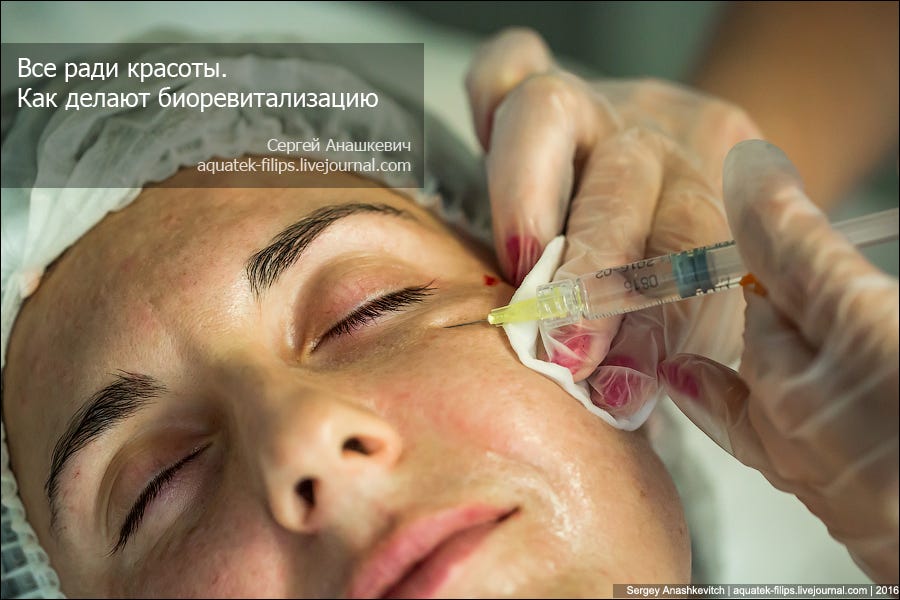 Как самой себе сделать биоревитализацию Как самой себе сделать биоревитализацию