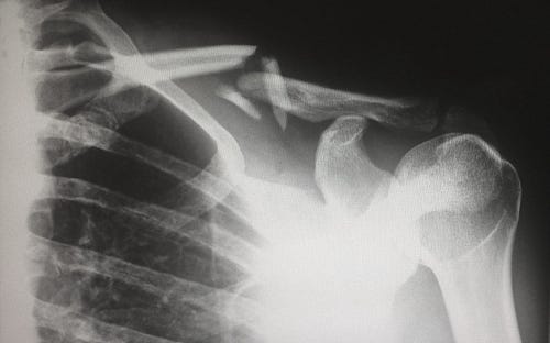 AI is changing the medical imagery industry🏆
