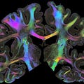 Go to the profile of Brain Byte