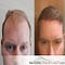 Go to the profile of Natural Transplants
