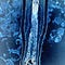 Hair Inside Out