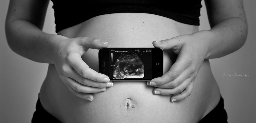 a pregnant woman wearing a sports bra and pants with her belly exposed holding a cellphone with a picture of her baby’s ultrasound on it