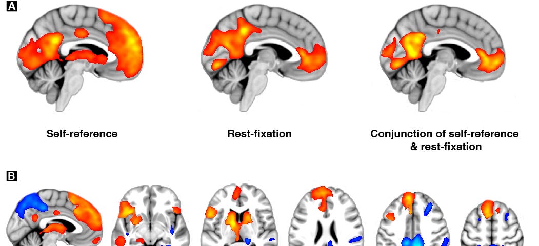 Brain activations during self-reference and rest show considerable overlap, but also distinct differences.
