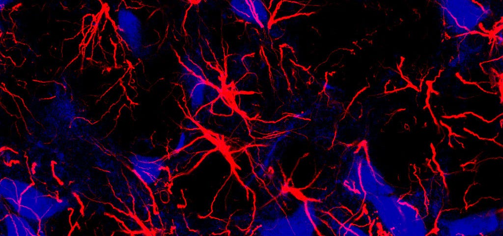 Star-shaped cells called astrocytes in the brain.