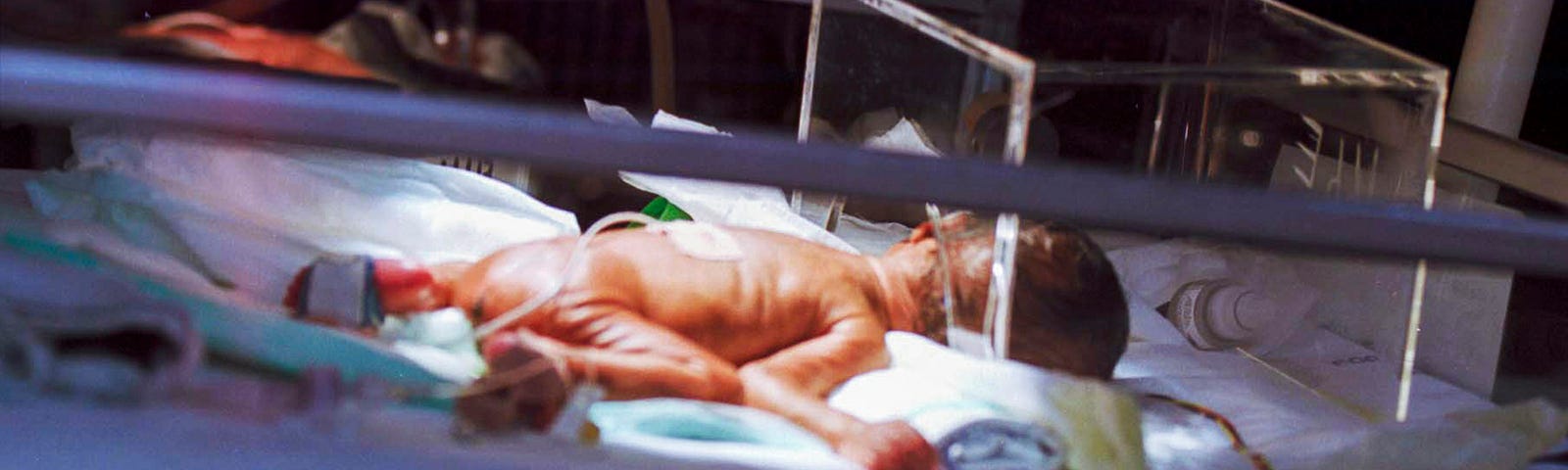 A tiny infant in an incubator