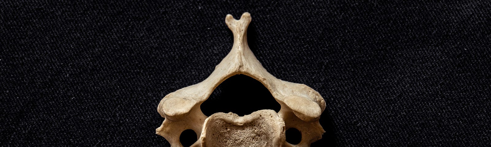 A vertebral segment is pictured on a dark background, in an article written by Dr. Erik Reich a chiropractor in Connecticut.