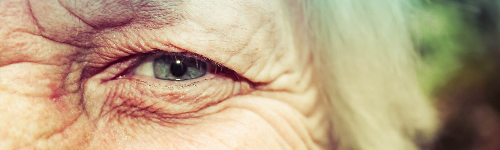 A close-up of an aging face showing the top left quarter (eye and nose)