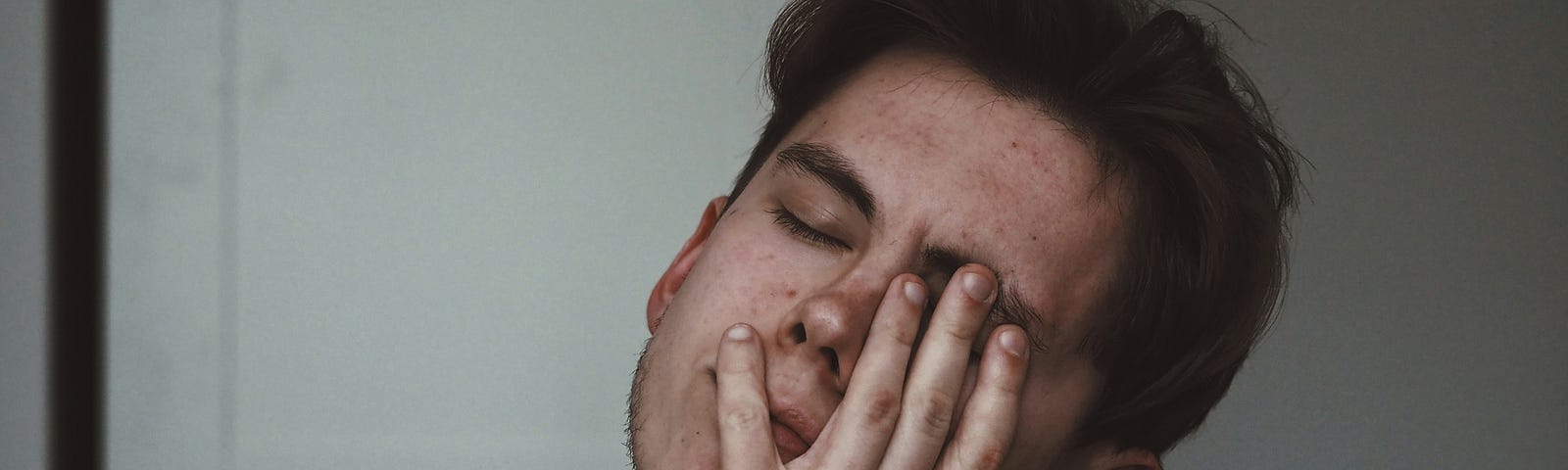 A man in a black shirt holding his face with one hand.