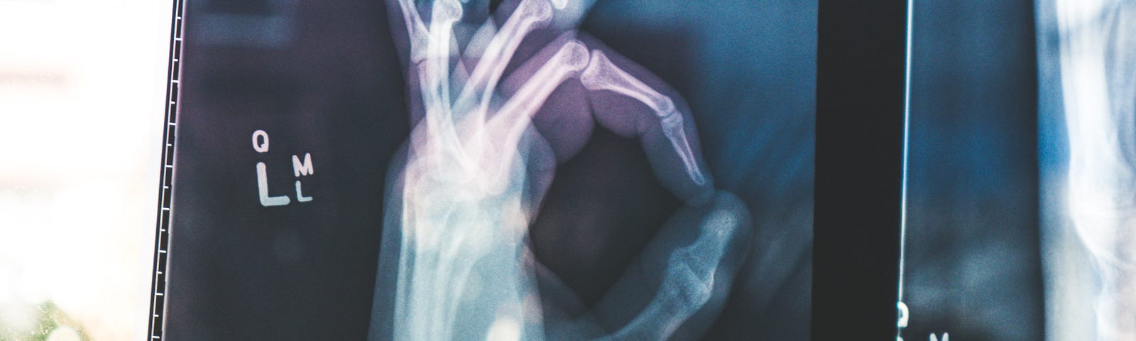 An x-ray of a hand doing the “okay” sign