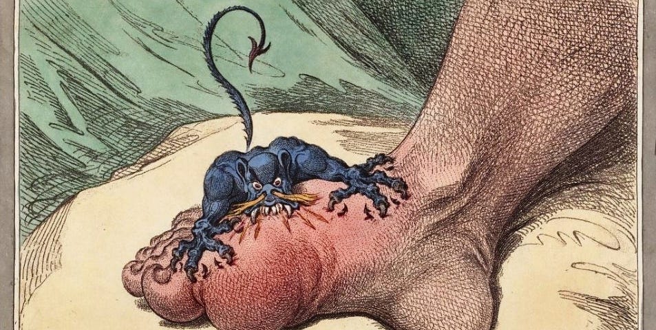 Caricature/cartoon of swollen foot with develop on top gnawing it. “The Gout by” James Gillray. Published May 14th 1799. Public domain.