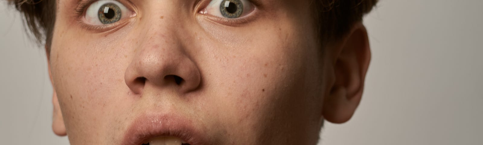 A young man looks surprised, his mout agape and eyes wide open and slightly protruding. He occupies most of the image, presenting from low-neck up to his lower forehead. Gray-white background.