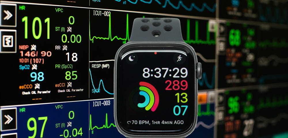 Apple Watch and the future of non-invasive bolod glucose testing