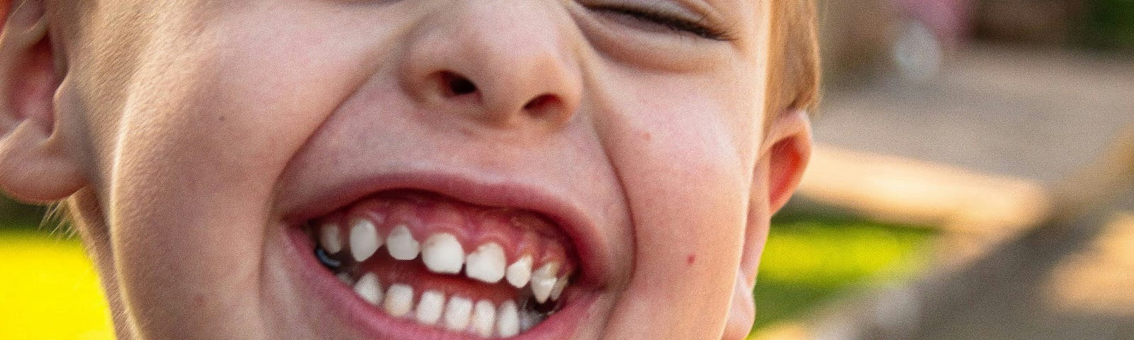 This image shows a young child with a joyful expression, squinting eyes, and a wide smile displaying missing front teeth. The child is wearing a checkered shirt with a mix of blue, red, yellow, and white patterns and a white undershirt. The background is blurred but suggests an outdoor setting with warm, natural lighting.