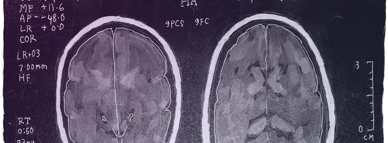 brain scans.