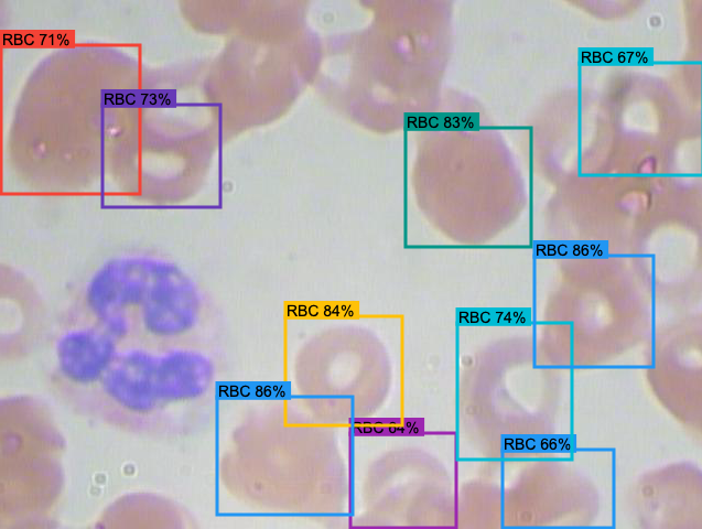 Red blood cell detection