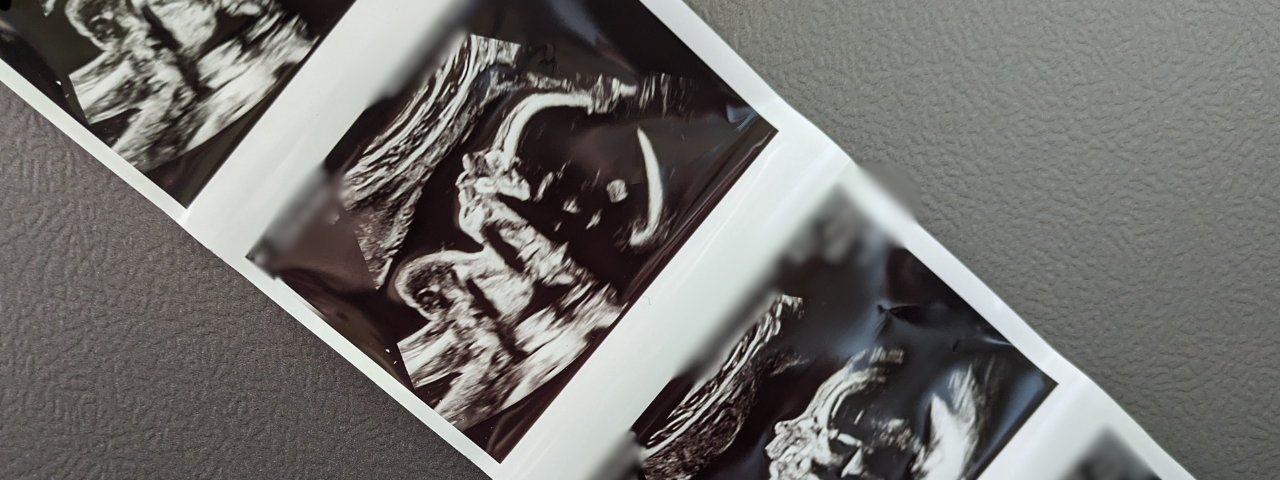 Author’s ultrasound photos