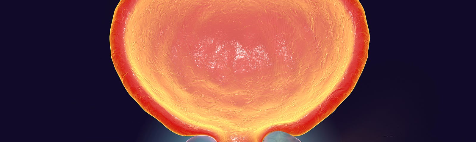 A cartoon depiction of the bladder at the top, with the urethra running downwards through the prostate. Cancer lights up in the prostate. One in eight men in the USA get prostate cancer.