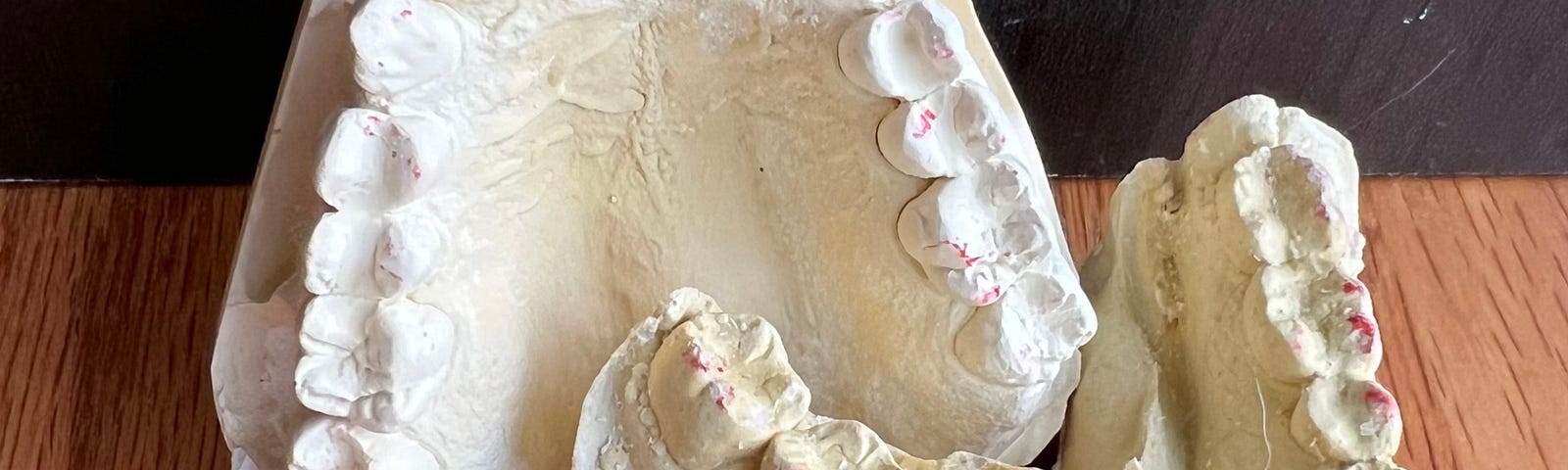 Plaster cast of upper and lower human dental arches and surrounding tissue, propped up on a wooden table.