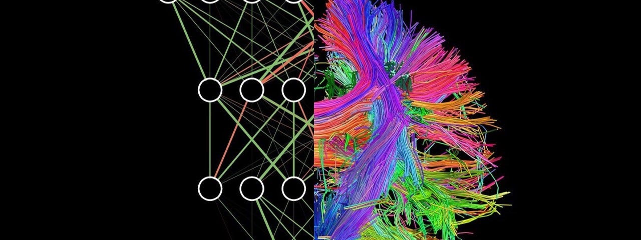 A mixture of an Artificial Neural Network and the Brain Connectome