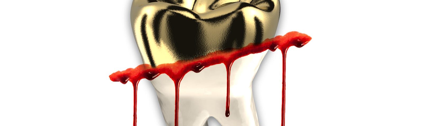 Illustration of a tooth with a gold crown. The white root of the tooth and the gold crown are separated by a streak of dripping blood.