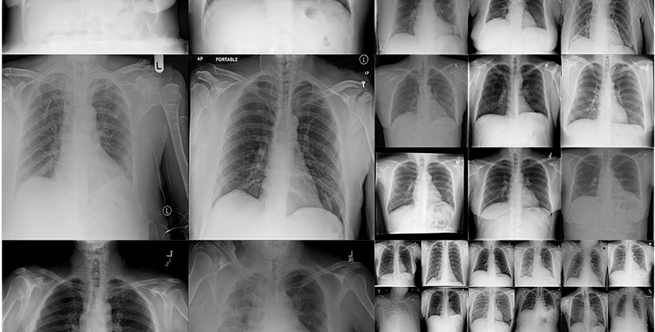 Grid of synthetic chest x-rays