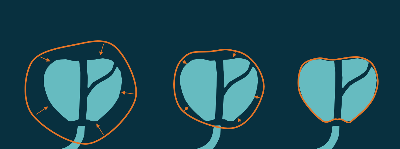 Deep learning for radiology volume measurements: an introduction to medical image segmentation