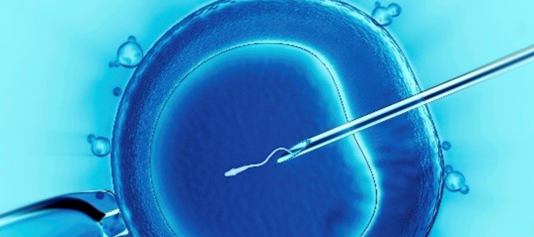 In Vitro Fertilization image