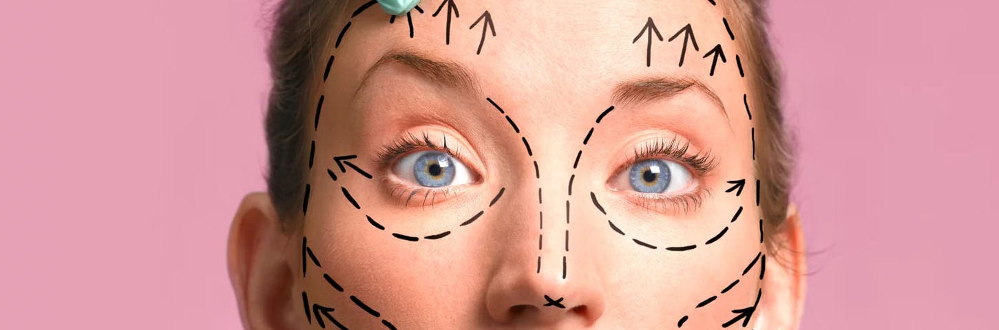 A woman with no wrinkles has lines drawn on her face, indicating where she needs a face lift