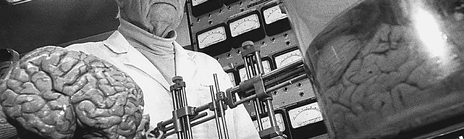 Dr. Robert White standing behind medical equipment and a brain in a jar