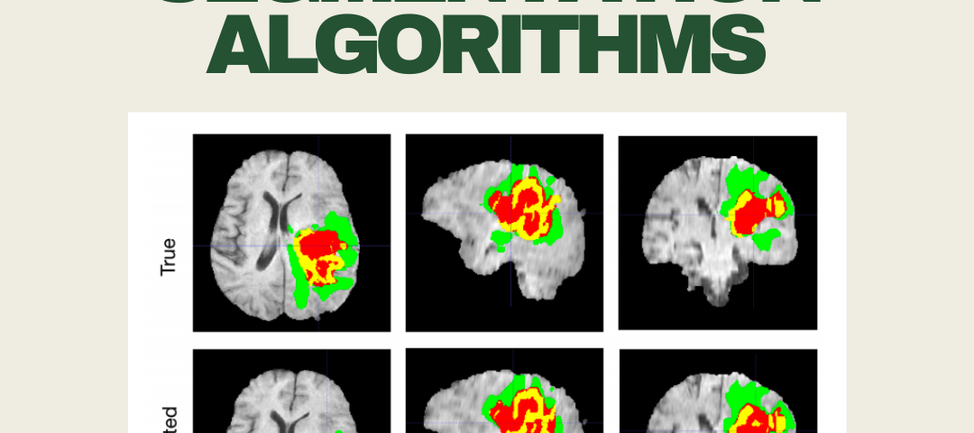 image of applications of segmentation algorithms. two rows of mri images labeled with regions of brain tumors. segmentation can be used to predict various cranial structures such as brain tumors from mri images.