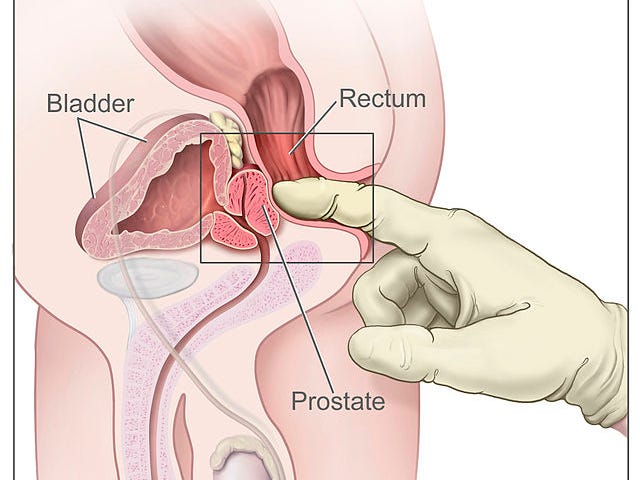 Cross section of a prostate exam