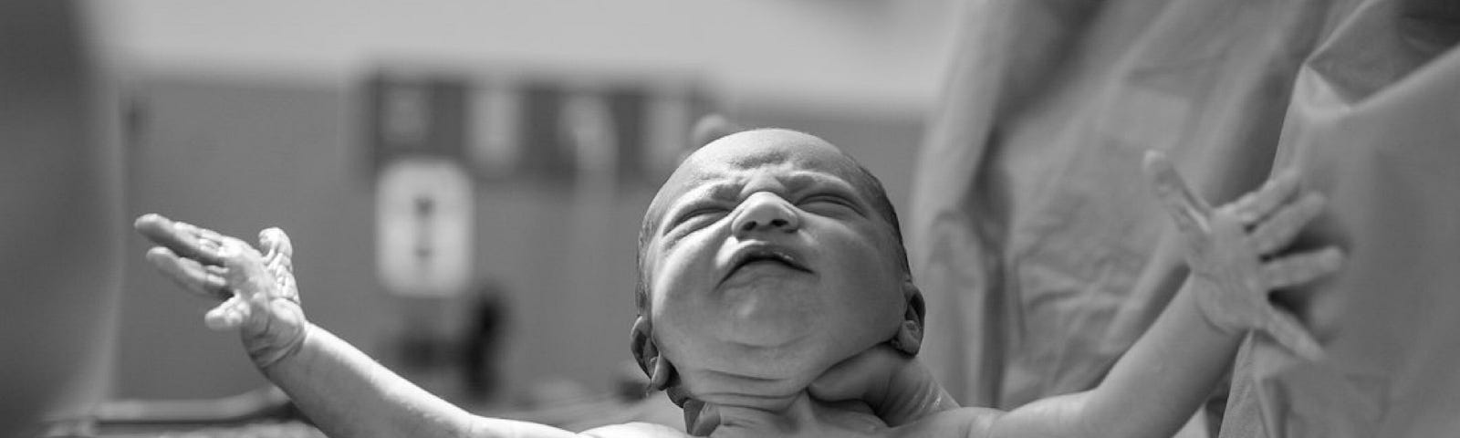 A black and white photo of a newborn baby, its arms open wide, being lifted in the delivery room immediately after birth. The baby is frowning and about to start crying.