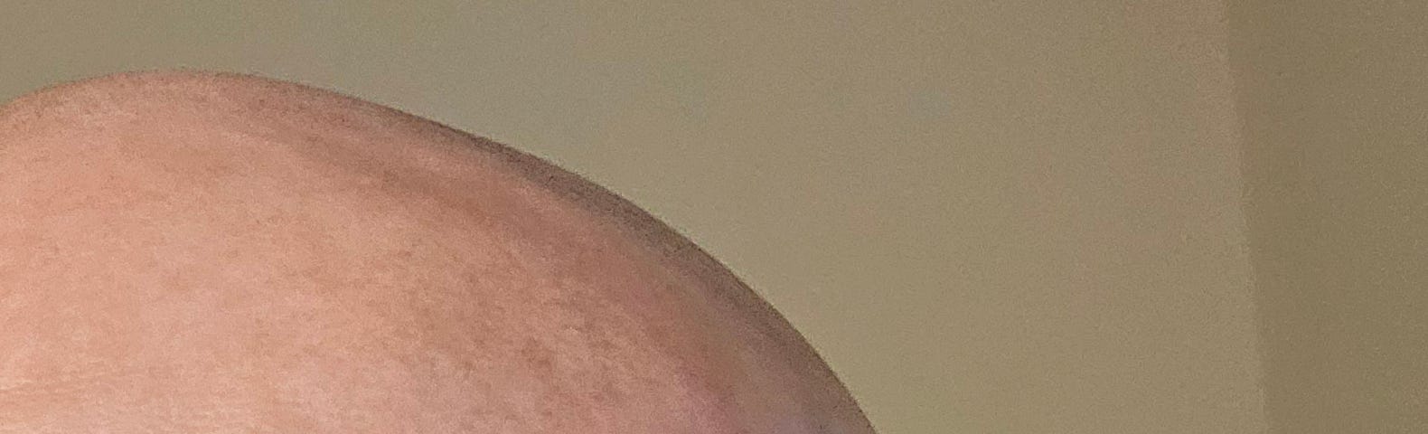 A bald ass head