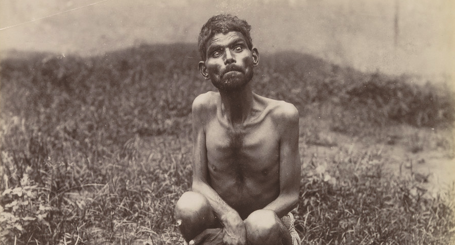 Dina Sanichar, the real-life Mowgli in his later years (ca. 1889–1894)