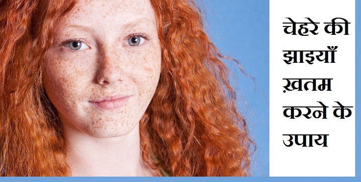 Natural freckles shared drunk