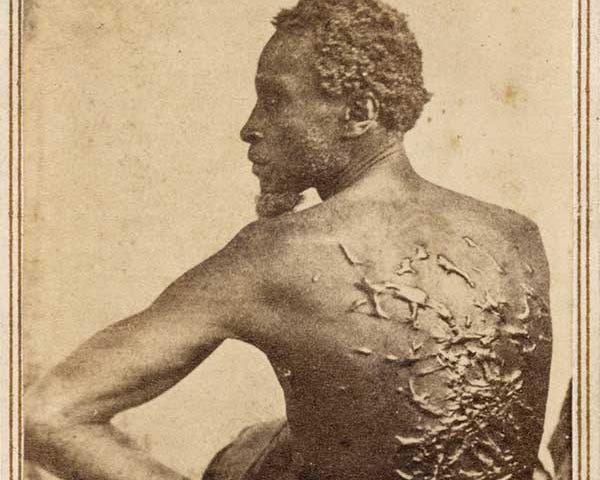 Scars of Gordon: The Story of a Whipped Louisiana Slave from 1863 - Rare  Historical Photos
