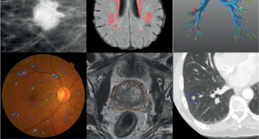 Biomedical Imaging – Analytics Vidhya – Medium