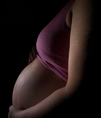 Pregnant female with stretch marks