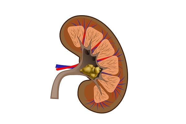 Kidney Stone Location Diagram - Aflam-Neeeak