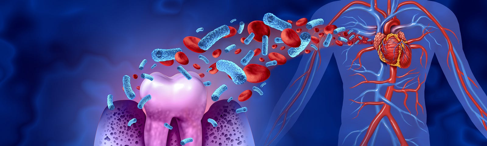 Cartoon of a tooth, with red blood cells exiting into arteries and veins in a translucent human body to the right. It is important to have good dental care. If the periodontal disease is advanced, it may be incurable. The gums may recede such that the teeth look longer.