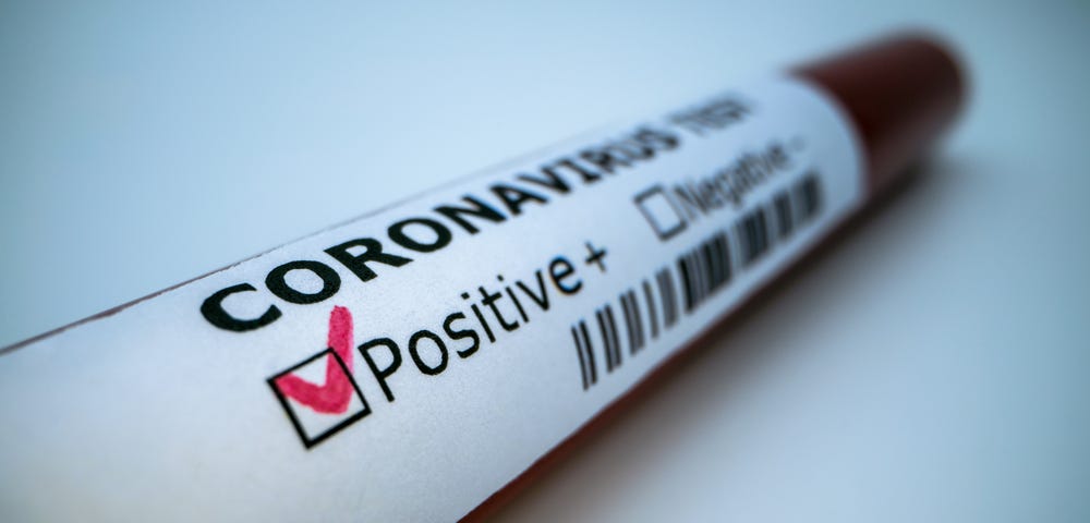 Image of a blood sample tube for a Coronavirus test marked positive.