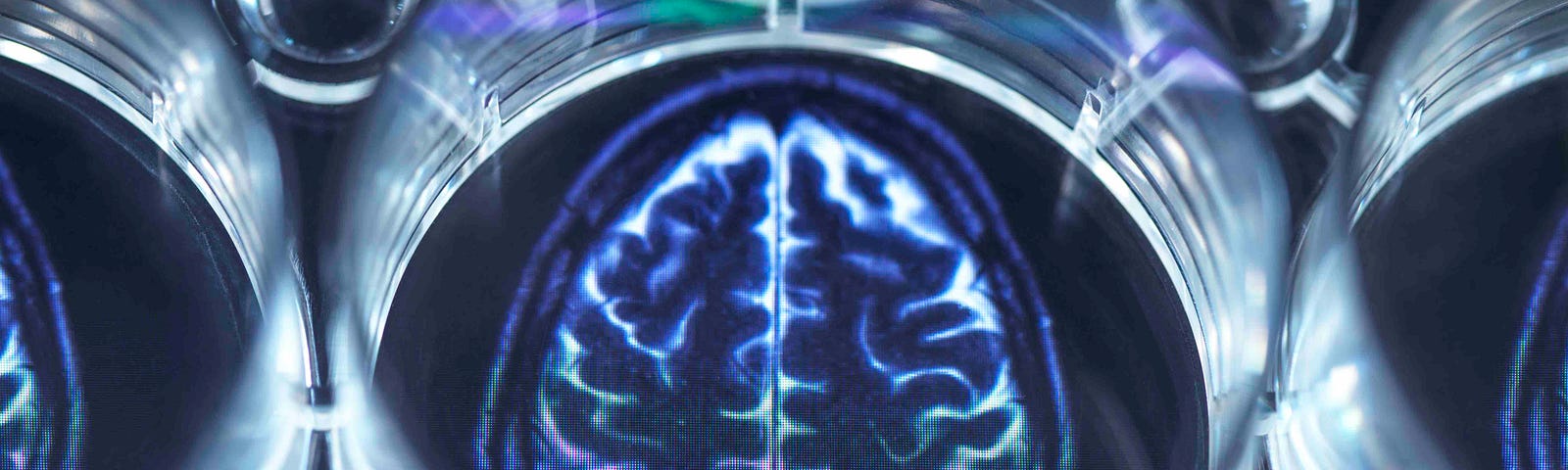 An image of a brain scan viewed through a petri dish.