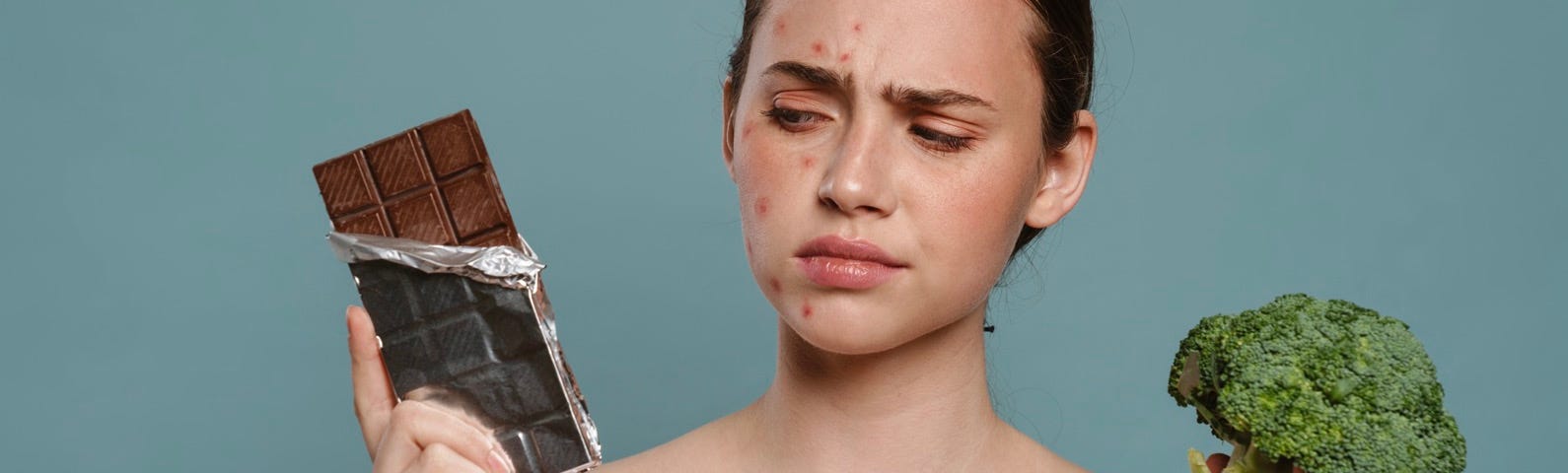 Young woman with acne holding a block of chocolate and broccoli