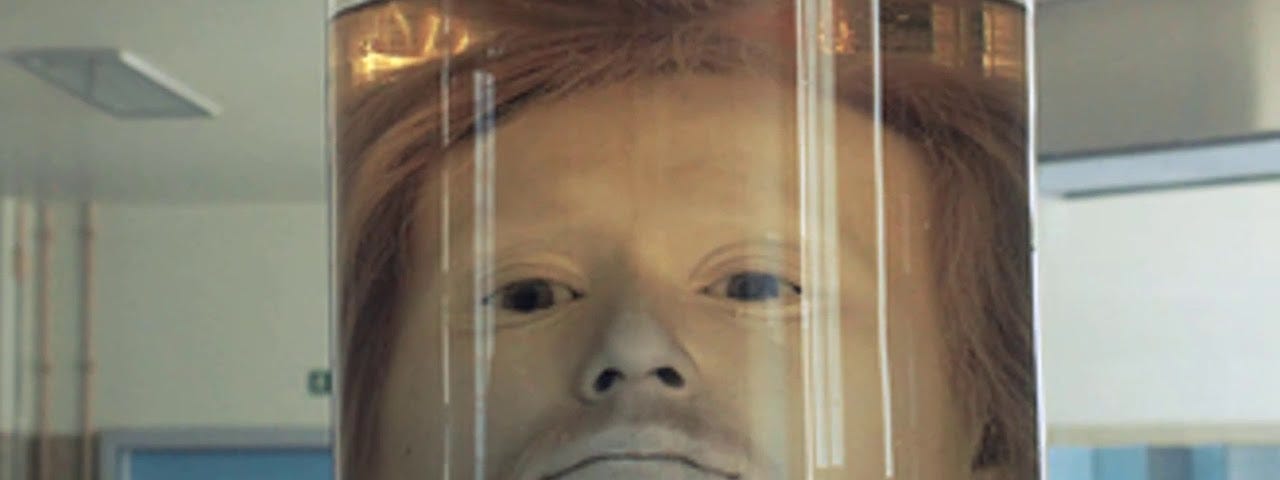 Diogo Alves’ head preserved in a jar in formaldehyde solution, in the University of Lisbon