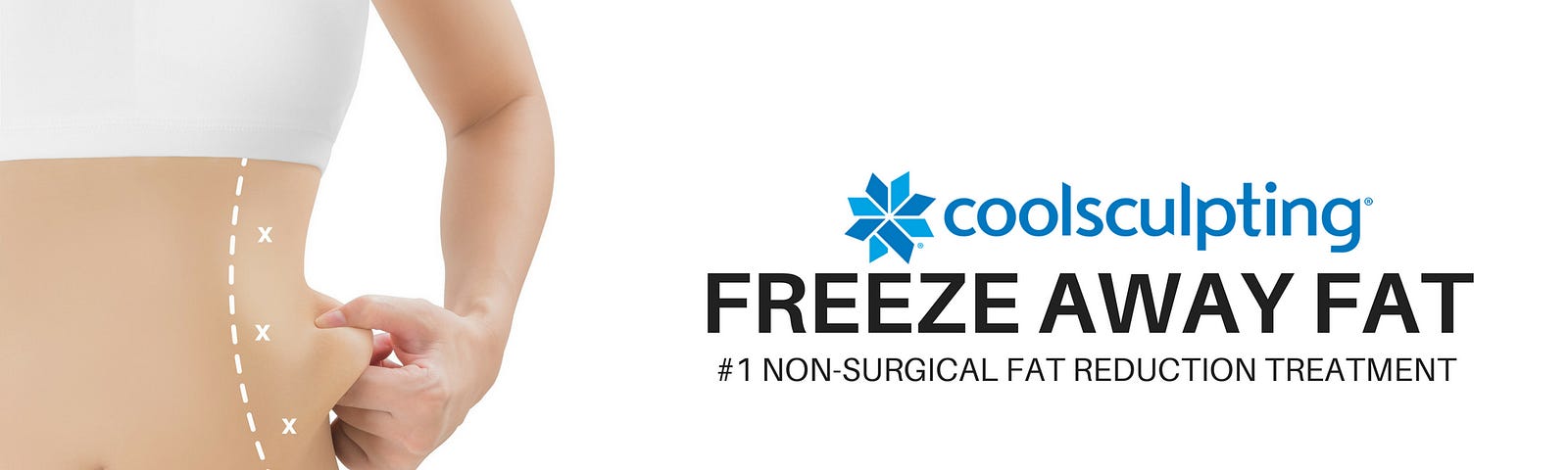 Top 4 Things You Must Know About CoolSculpting.