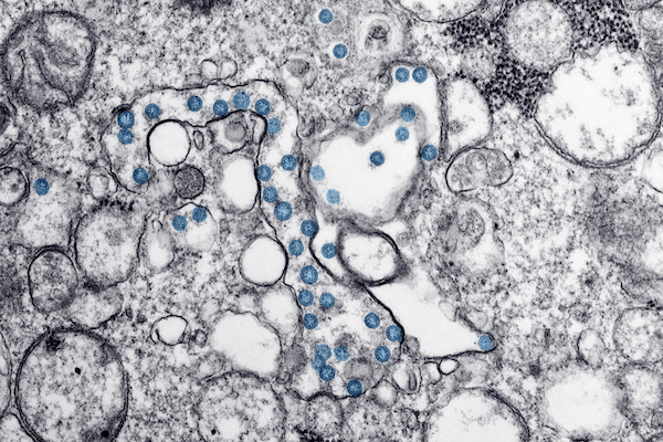 Coronavirus molecular view