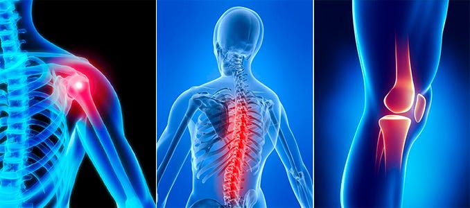 boli degenerative degenerative ale coloanei vertebrale și articulațiilor)