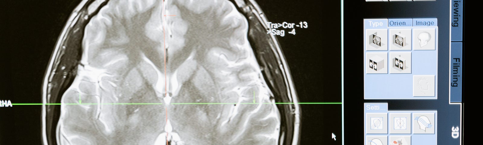Image scan of the brain