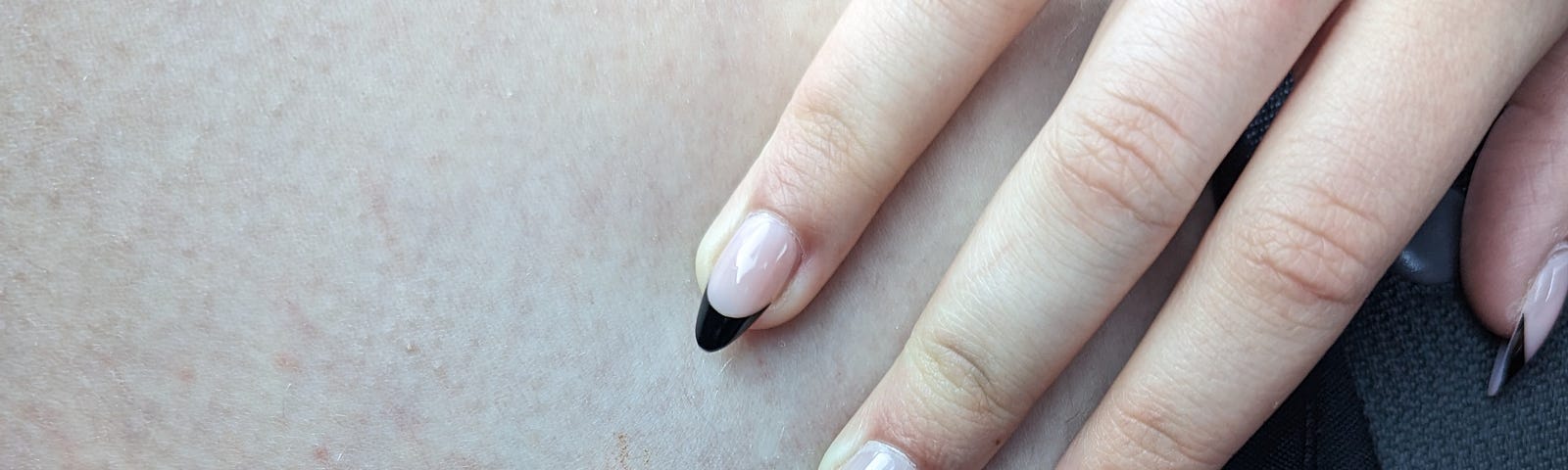 A bloody injury next to manicured nails.