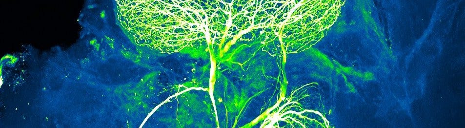 a neuron